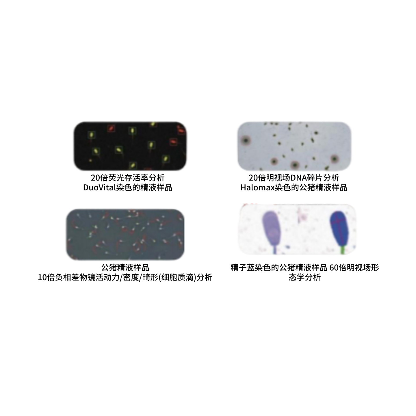 Fully automatic sperm quality analysis CASA system product image